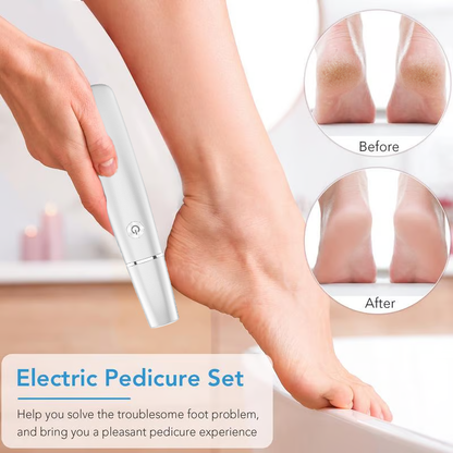 🔥Last Day Promotion 50% OFF🔥2025 NEW USB Rechargeable Feet Repair and Grinding Device