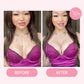 🔥Buy 1 Get 1 Free (2 Pairs)🏆Self Adhesive Boob Bra Pads