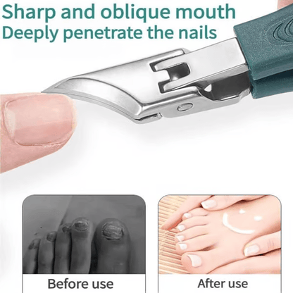 🔥Last Day Sale 49% OFF🔥Eagle Beak Angled Nail Clippers 3-Piece Set