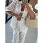 🔥Summer Big Sale 49% OFF!!💃Women's Casual Lace Two-Piece Set