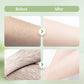⏳LAST DAY SALE 70% OFF👍💕PureSoothe™  Ultra-Gentle Non-Irritating Hair Remover🌿