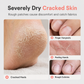 🔥LAST DAY SALE ONLY ￡6.99!!🔥Intensive moisture-lock for dry hands & feet — in a pocket stick. 🧴💧